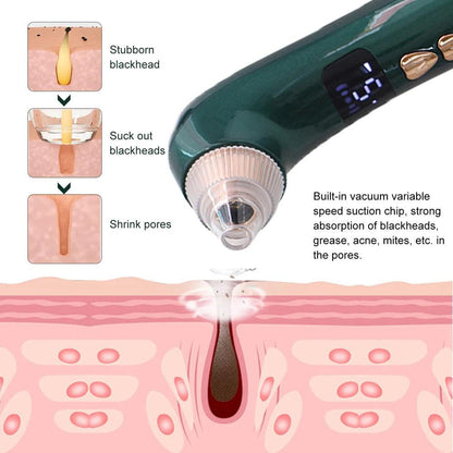 Blackhead Remover Pore Vacuum Camera Pore Cleaner Acne Remover Electric Heating Nose Face Deep Cleansing WIFI Microscope