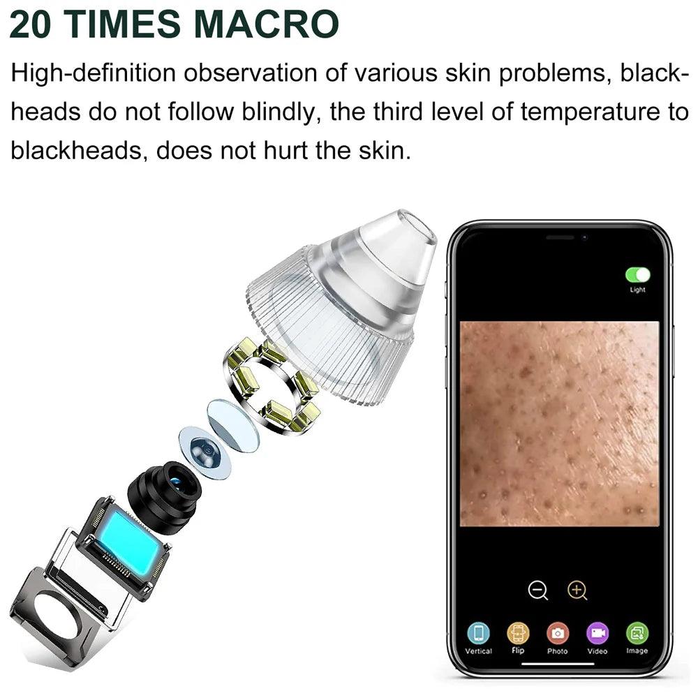 Blackhead Remover Pore Vacuum Camera Pore Cleaner Acne Remover Electric Heating Nose Face Deep Cleansing WIFI Microscope