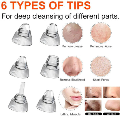 Blackhead Remover Pore Vacuum Camera Pore Cleaner Acne Remover Electric Heating Nose Face Deep Cleansing WIFI Microscope