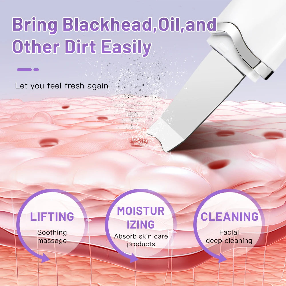 Electric Ultrasonic Skin Scrubber Vibration Face Spatula Peeling Blackhead Remover Facial Lifting Cleansing Ultrasonic Skin Care