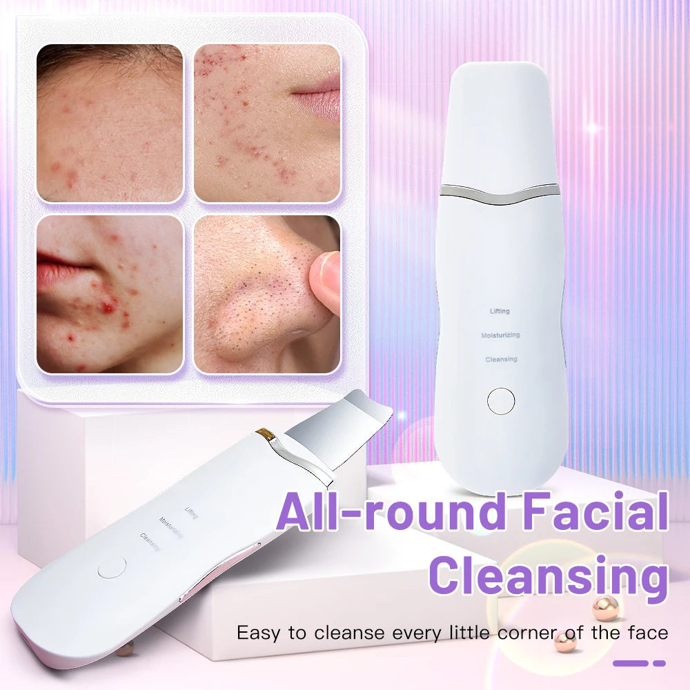 Electric Ultrasonic Skin Scrubber Vibration Face Spatula Peeling Blackhead Remover Facial Lifting Cleansing Ultrasonic Skin Care